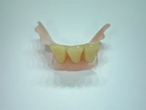 Provisorisk tandprotese